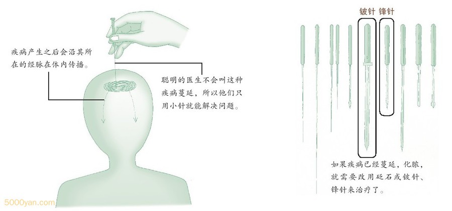 С�����δ󲡲�ͼ