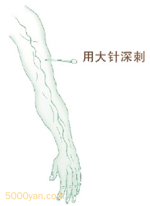 ͬʱͼ