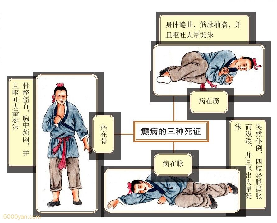 񲲡ıƲͼ